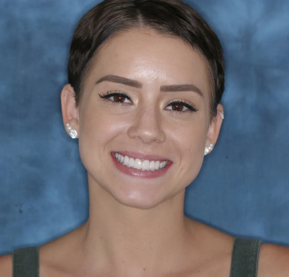 A real patient smile at Perfect White Smile