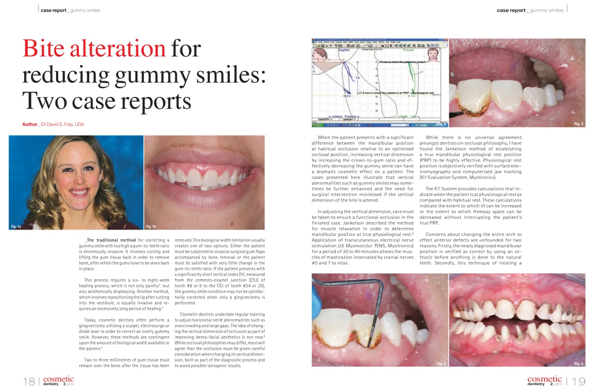 Perfect White Smile patient feature