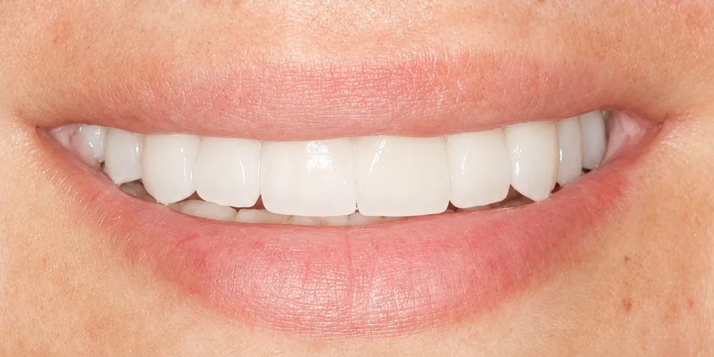 After: Cosmetic dentistry