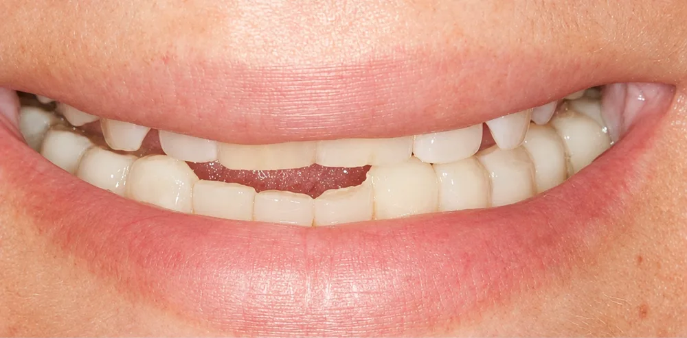 Before: Cosmetic dentistry