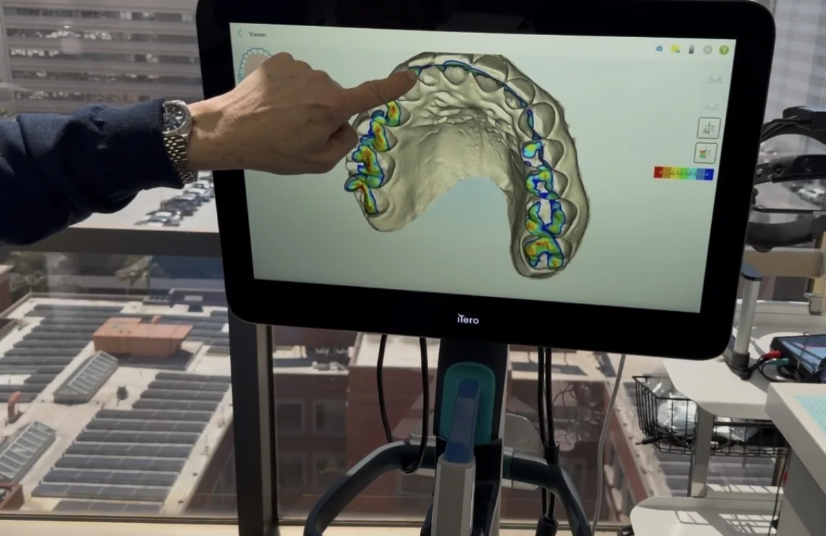 iTero 3D scanner at Perfect White Smile