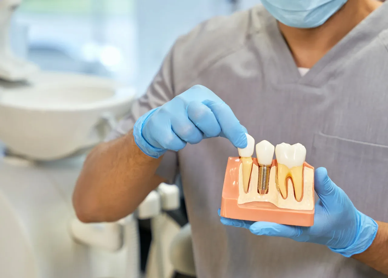 Dental Implants at Perfect White Smile