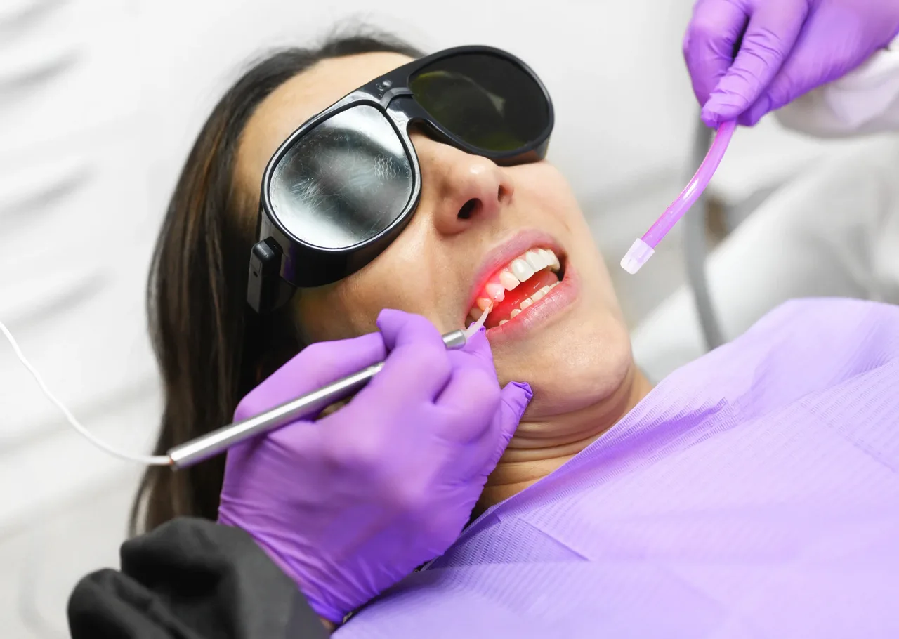 Laser Dentistry at Perfect White Smile