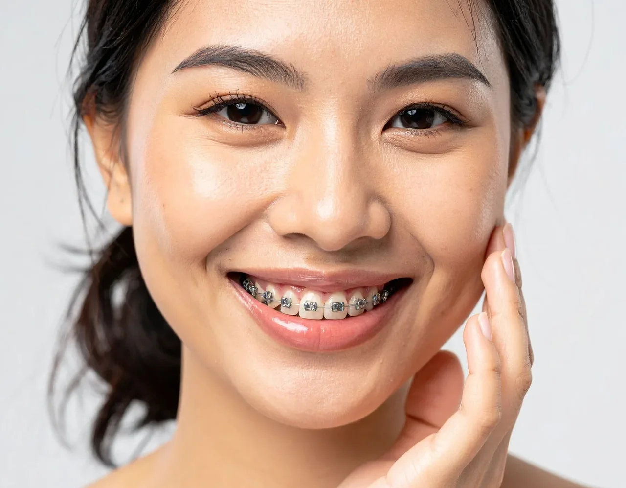 Invisalign and Orthodontics at Perfect White Smile