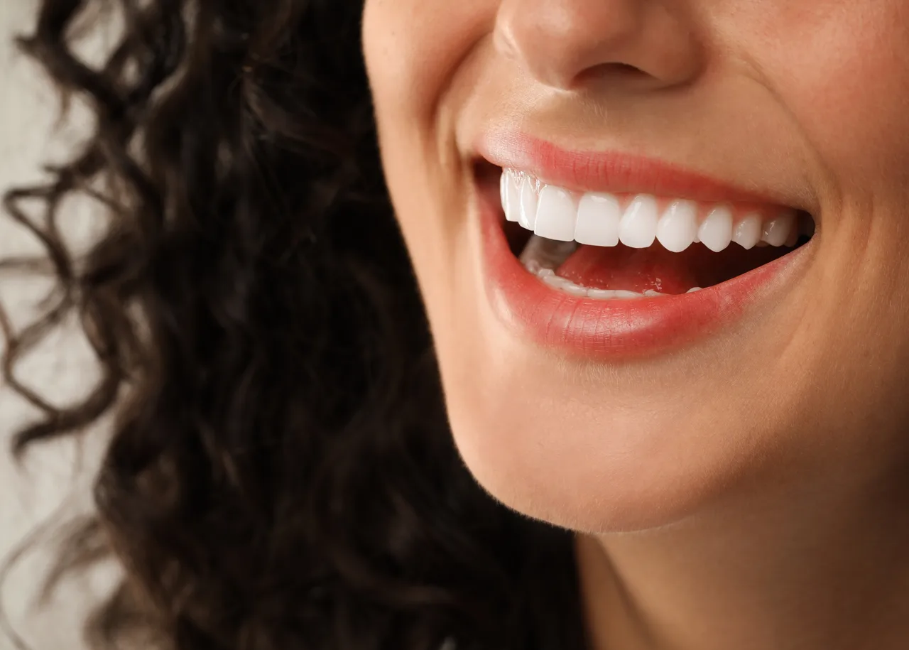 Porcelain Fillings at Perfect White Smile