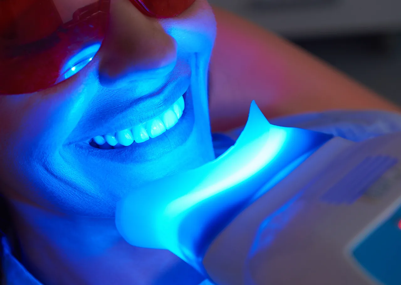 Teeth Whitening at Perfect White Smile