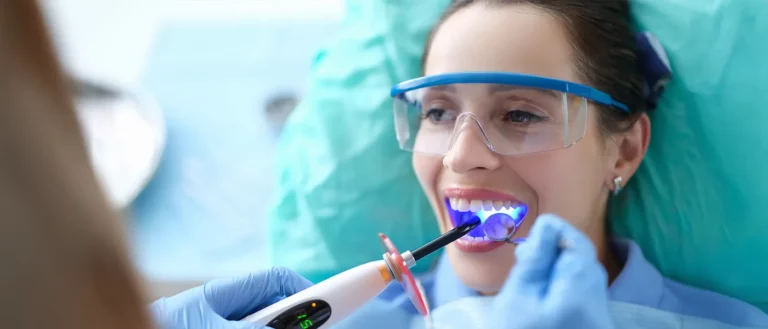 Bonding vs Veneers